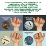 Elimina el hongo de tus Uñas (50ml)