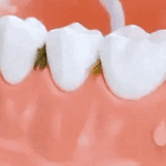 IRRIGADOR ORAL ANTISARRO RECARGABLE