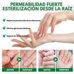 Elimina el hongo de tus Uñas (50ml)