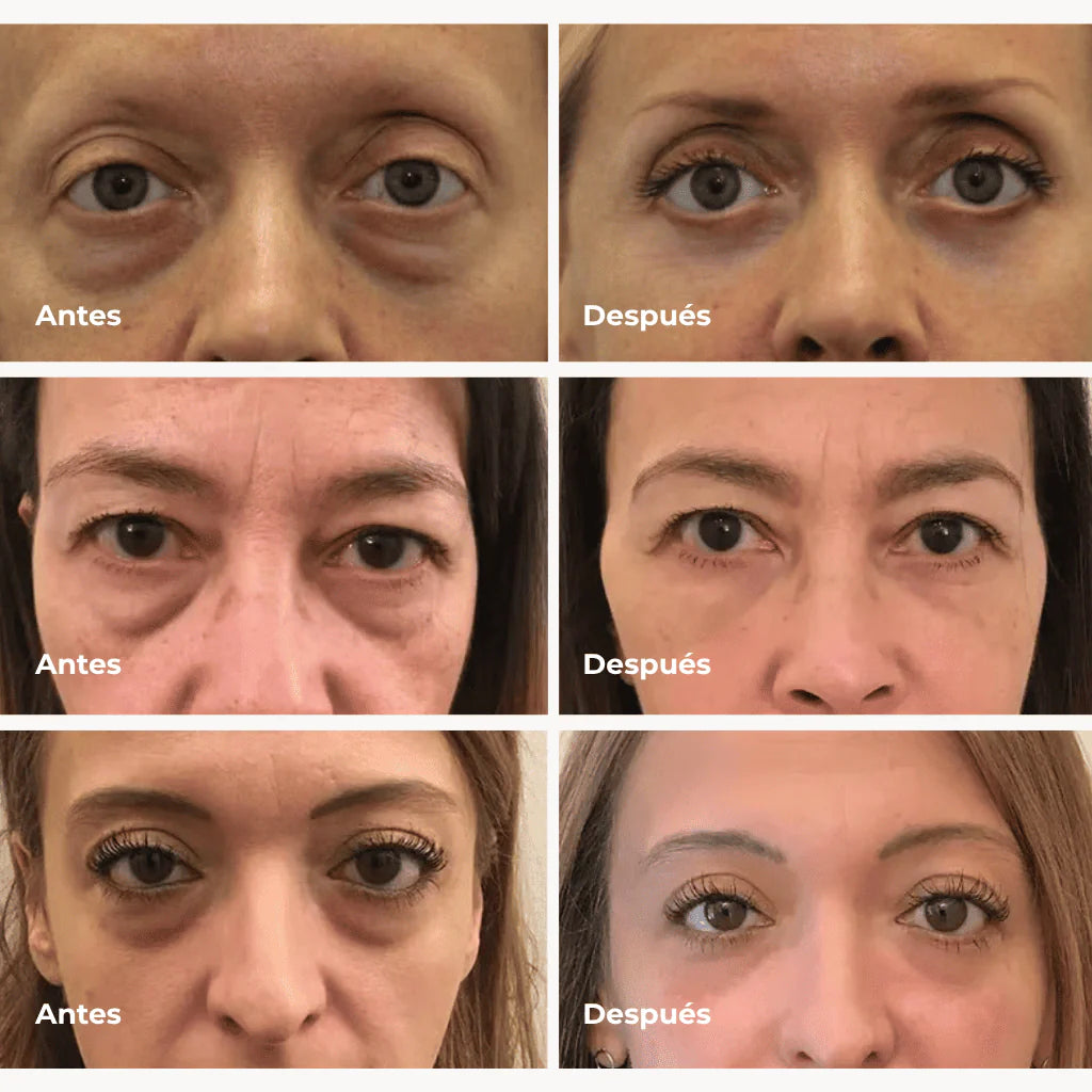 PARCHE DE COLAGENO PURO + ENVIO GRATIS