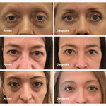 PARCHE DE COLAGENO PURO + ENVIO GRATIS