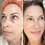 PARCHE DE COLAGENO PURO + ENVIO GRATIS