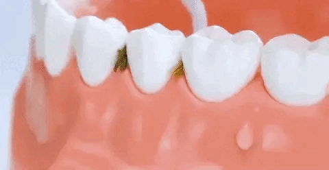 IRRIGADOR ORAL ANTISARRO RECARGABLE