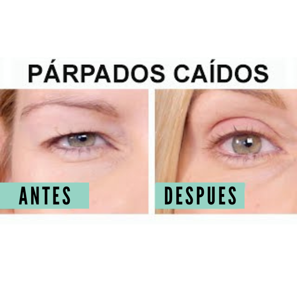 Lifting Cinta para parpados + Envío gratis